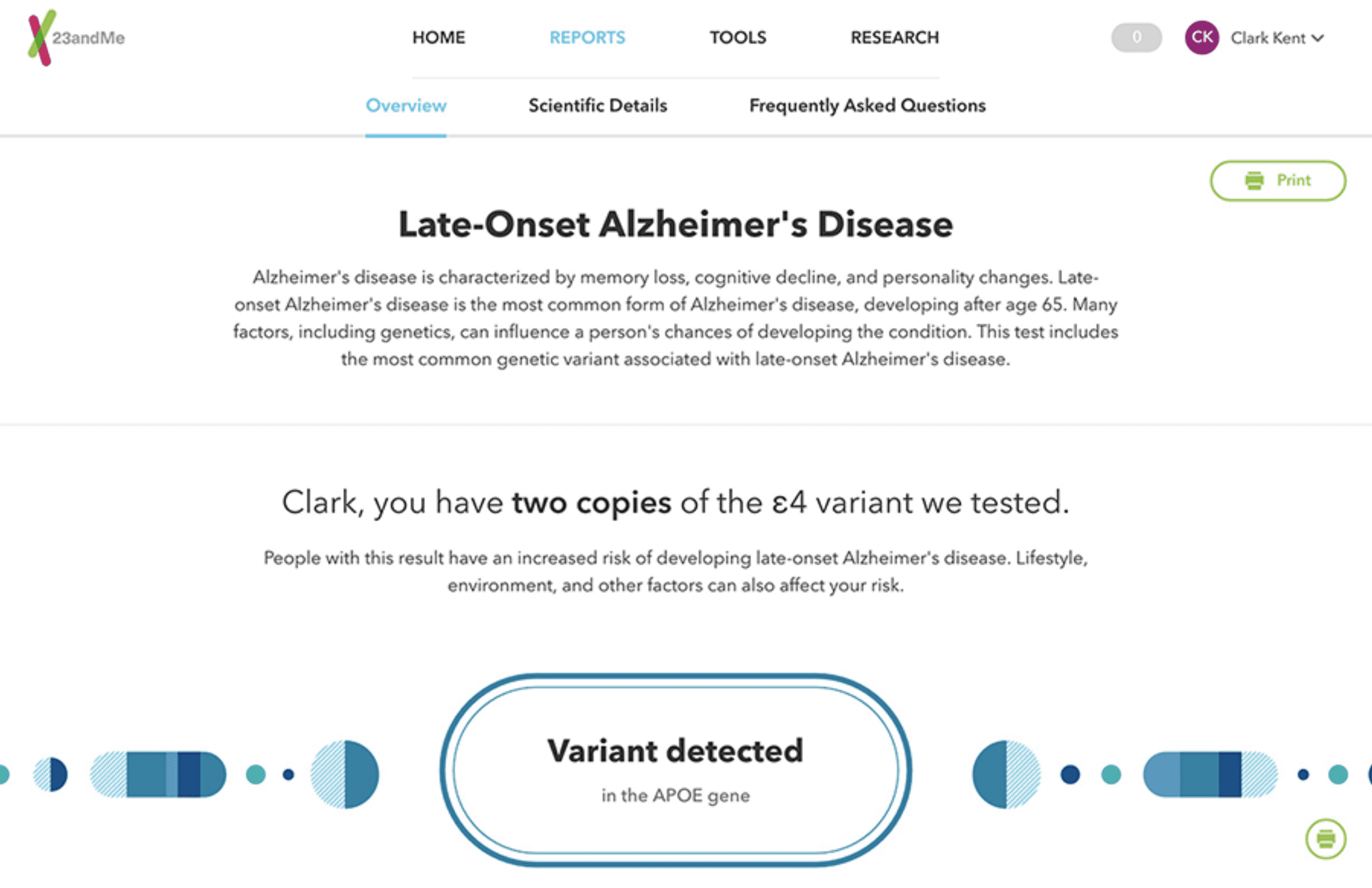Late-Onset Alzheimer’s 2 variants